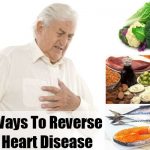 How to Reverse Heart Disease Naturally